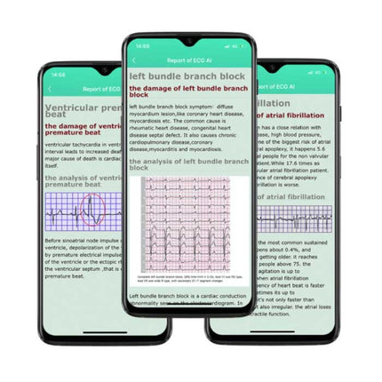 E86 ECG Smartwatch met Extra Bandje - Fitness Sport Activity Tracker Horloge Android - TPU Bandje Rood