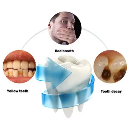 Sonische U-Type Tandenborstel - Elektrisch 360° Siliconen Kop - Wit